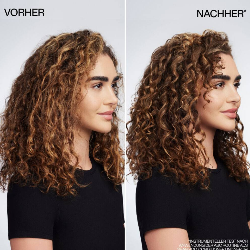 Vergleich vorher nacher